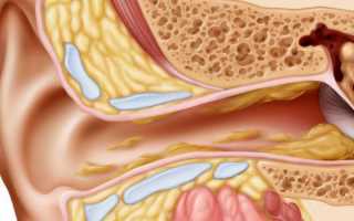 Как и чем почистить уши от серы в домашних условиях?