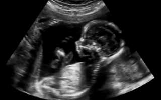Беременность на 16 неделе: фото, 3д-УЗИ