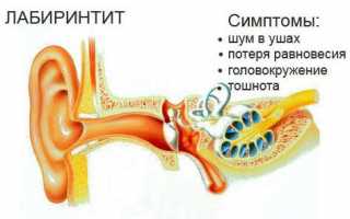 Чем лечат отит у взрослых?