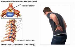 Болит позвоночник посередине спины — что это может быть?