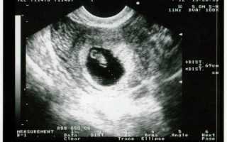 6 недель беременности: размер плода на фото УЗИ