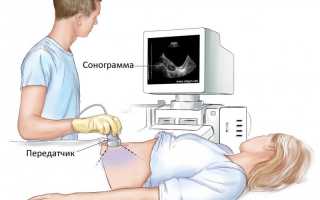 Как проводится УЗИ придатков матки?
