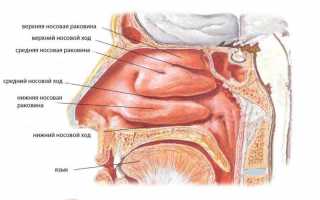 Что такое ультразвуковая дезинтеграция нижних носовых раковин?