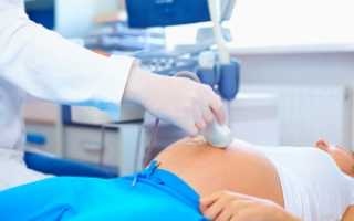 Что такое допплерометрия для беременных?