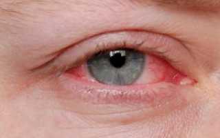 Глазные капли от воспаления для профессионального лечения