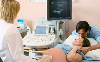 Сколько стоит УЗИ на беременность?