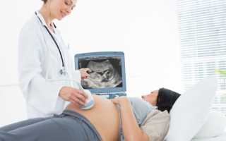 на каком сроке делают 3 скрининг при беременности?