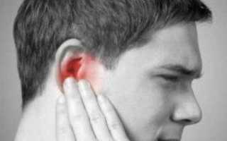 Как лечить простывшее ухо в домашних условиях?