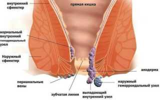 Перианальный вид дерматита: способы лечения и профилактики в разных случаях
