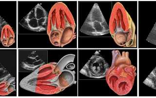 УЗИ сердца: что покажет эхокардиография