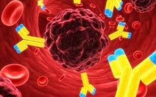 Использование моноклональных антител при лечении псориаза