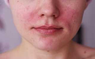 Опасный макияж — какая косметика может вызвать аллергию?