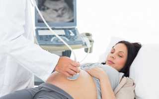На какой неделе делают второй скрининг при беременности?