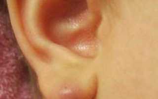 Как убрать шарик в мочке уха?