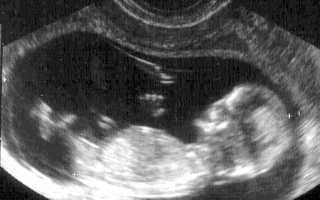 Каковы показатели нормы для эмбриона на 12 неделе?