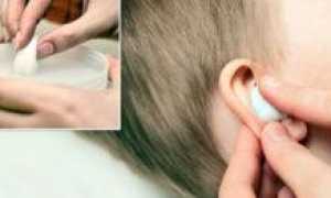 Как промывать ухо перекисью водорода?