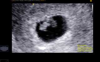 На какой неделе на УЗИ видно эмбрион?