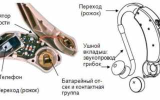 Как работает слуховой аппарат?