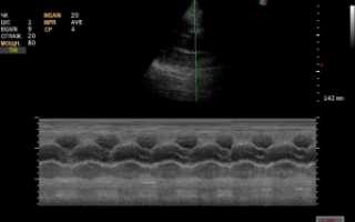 Подготовка к УЗИ сердца