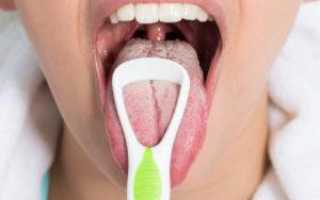 Лечение кандидоза полости рта