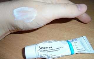 Чем можно заменить Адвантан при аллергических проявлениях на коже