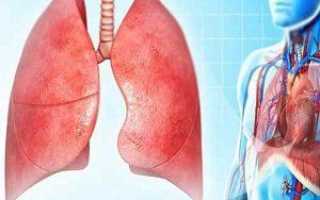Может ли быть пневмония без кашля?