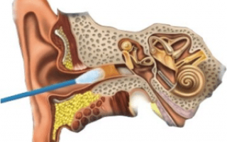 Причины тяжести и заложенности в ушах