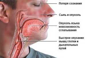 Супрастин или Кларитин: чему отдать предпочтение