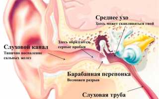 Как выглядит барабанная перепонка?