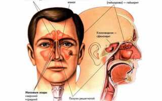 Как проводится операция на гайморовой пазухе?