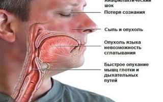 Дипроспан – сильнодействующий раствор для инъекций от аллергии