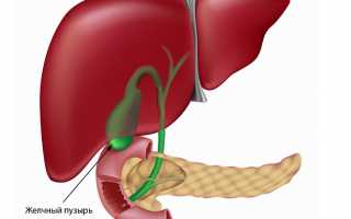 Холецистит — что это за болезнь, симптомы и лечение у взрослых