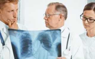 Как лечить воспаление лёгких