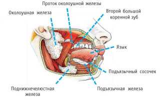 Как лечат сиалоаденит околоушной слюнной железы?