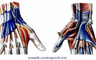 Тендовагинит лучезапястного сустава – лечение разных форм патологии