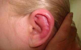 Какие существуют болезни среднего уха?