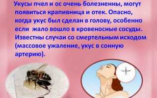 Опасный враг в полоску: аллергия на укус осы