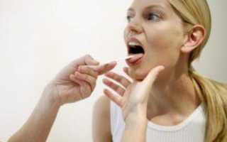 Как лечить кисту в горле