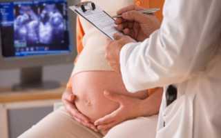 Дородовой геморрой у беременных женщин