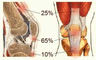 Тендинит коленного сустава: симптоматика, алгоритм лечения, упражнения ЛФК
