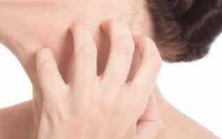 Аллергические реакции на теле человека: их причины и способы устранения