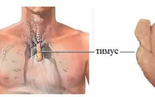 Для чего проводят УЗИ тимуса у детей