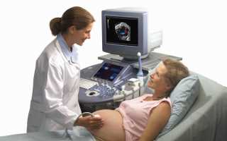 Какое количество УЗИ допустимо при беременности?
