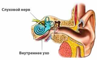 Как лечить слуховой неврит народными средствами?